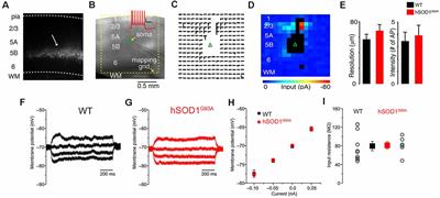 The Electrophysiological Determinants of Corticospinal Motor Neuron Vulnerability in ALS